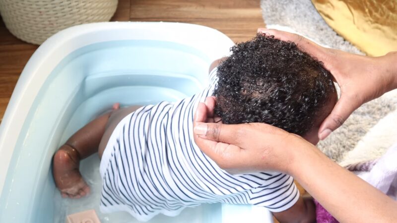 Baby Cradle Cap oil